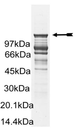 Eurofins DiscoverX Abl (H396P) Protein, Active 10 &mu;g | Buy Online | Eurofins DiscoverX | Fisher Scientific